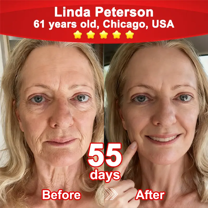 Stem Cell–Powered NAD+ Activating Collagen Peptide Oral Solution - Image 5