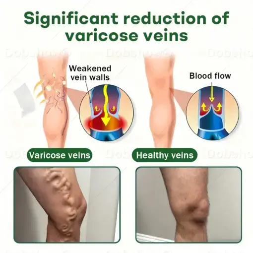 VeinLock Microneedle Patch - Image 3