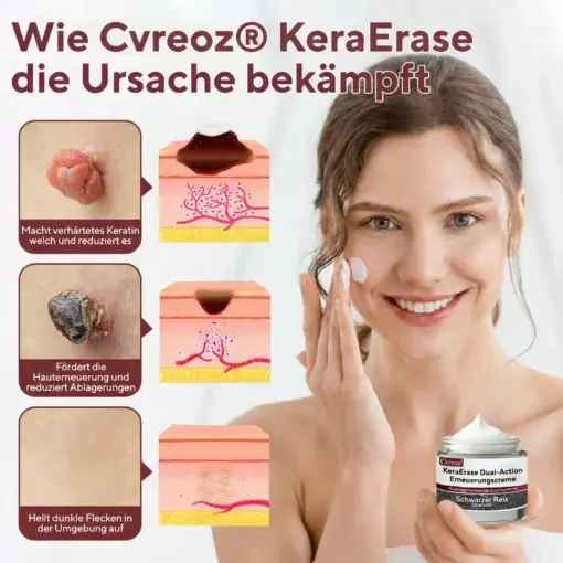 KeraErase Dual-Action Erneuerungscreme - Image 2