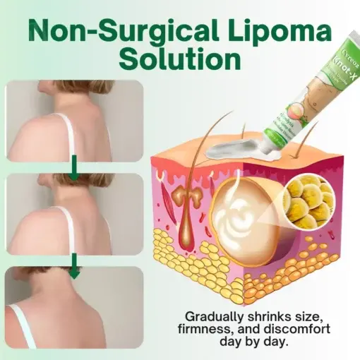 Knot-X Lipoma Dissolve Cream - Image 6