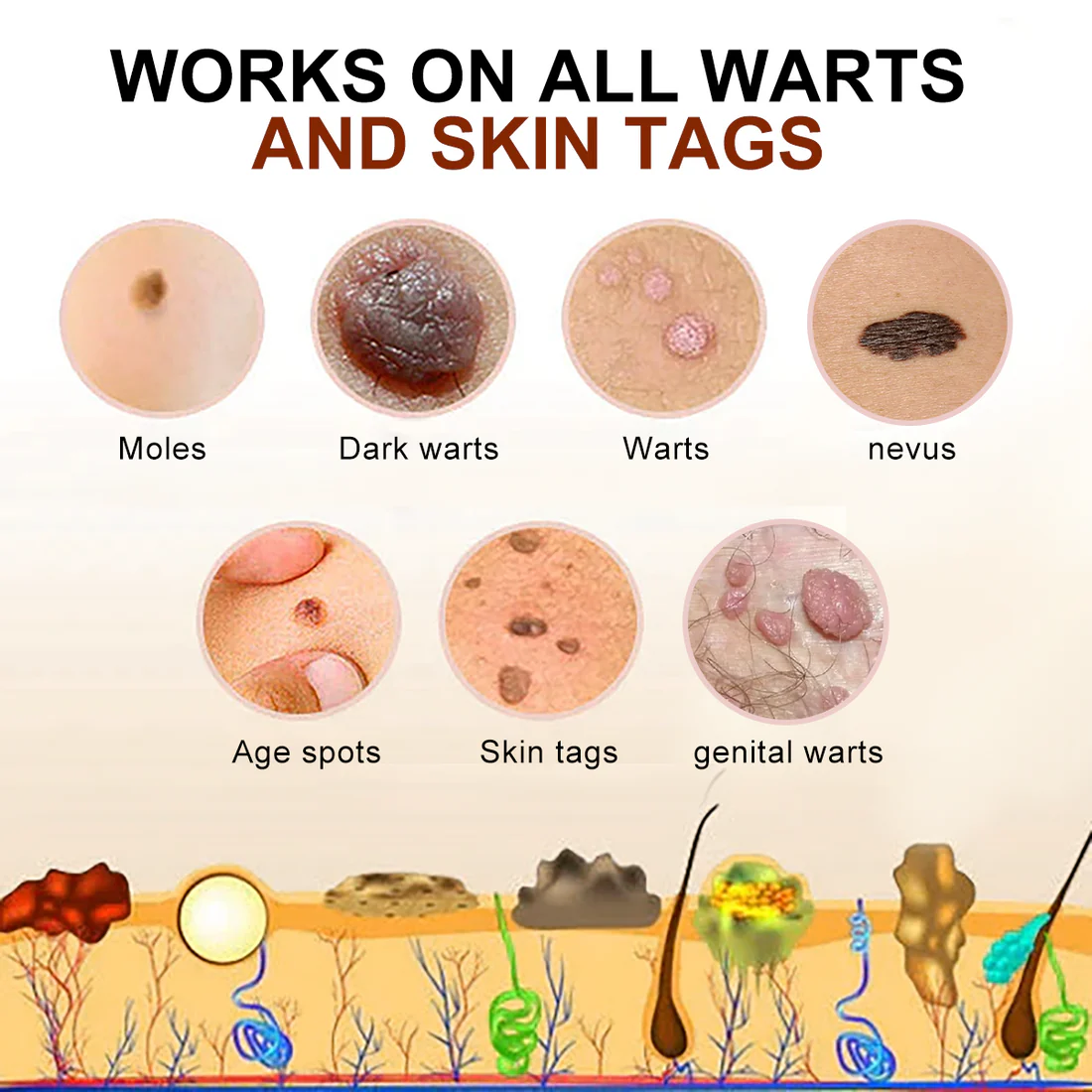 PRO Bee Venom Mole and Wart Treatment Cream - Image 2