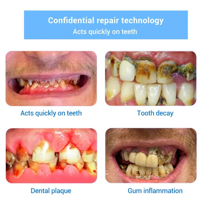 Teeth Restoration Mineral Powder - Image 15