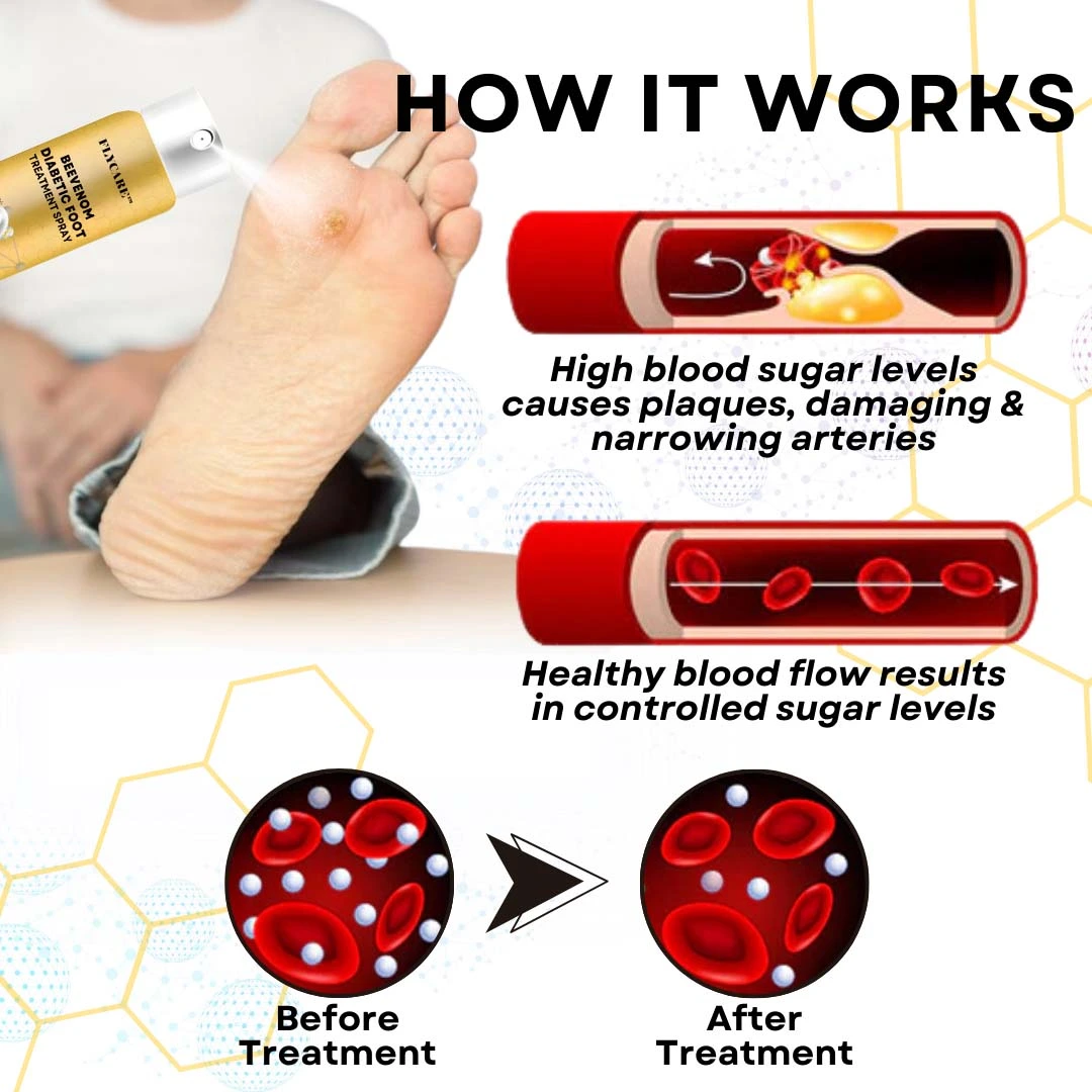 BeeVenom Diabetic Foot Treatment Spray - Image 5
