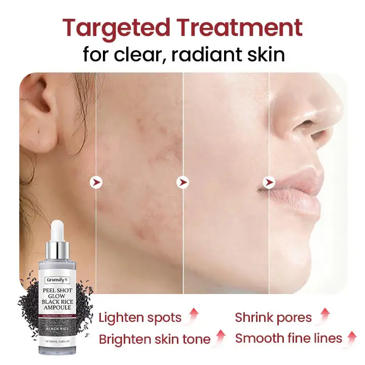 Peel Show Glow Black Rice Ampoule - Image 3