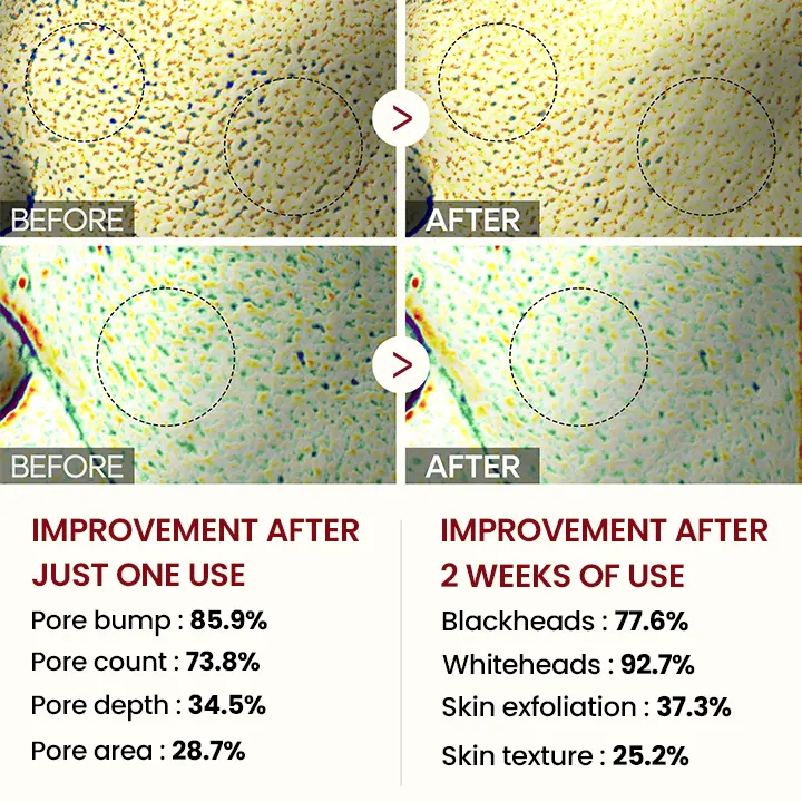 Peel Show Glow Black Rice Ampoule - Image 6