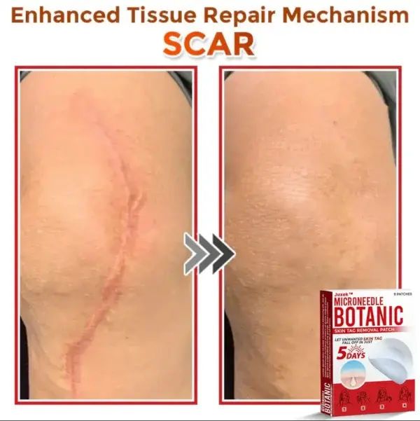 Removal Patch - Image 11