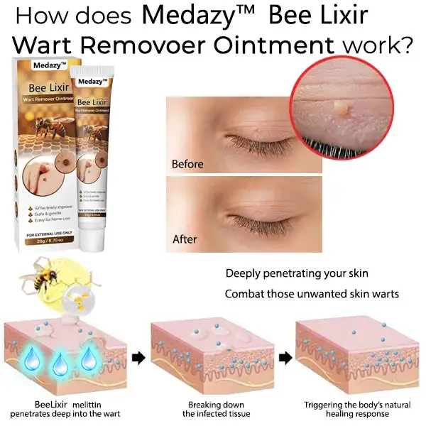 Bee Lixir Wart Remover Ointment - Image 2