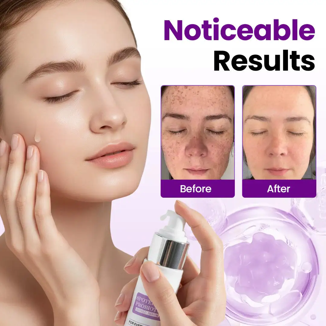 SpotErase Probiotic Shield Serum - Image 2