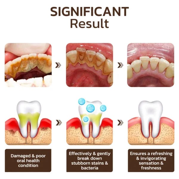 Niacinamide Intensive Whitening Toothpaste - Image 5