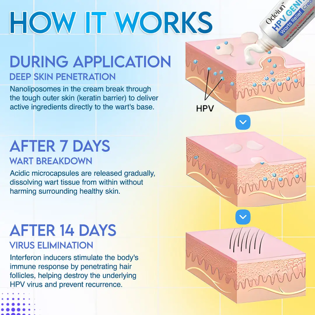 HPV Genital Warts Relief Cream - Image 5