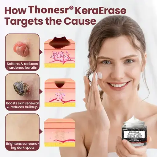 KeraErase Dual-Action Renewal Cream - Image 2