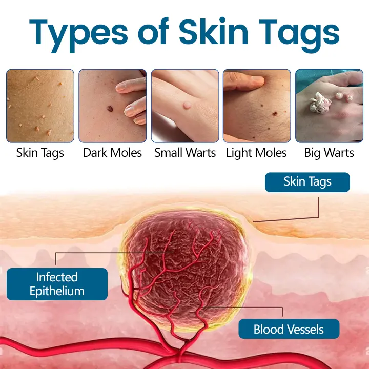 DermaVenom RX+ Precision Removal Cream - Image 7