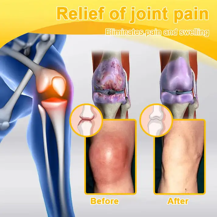 Botulinum Toxin and Bee Venom Pain Relief Bone Healing Cream - Image 10