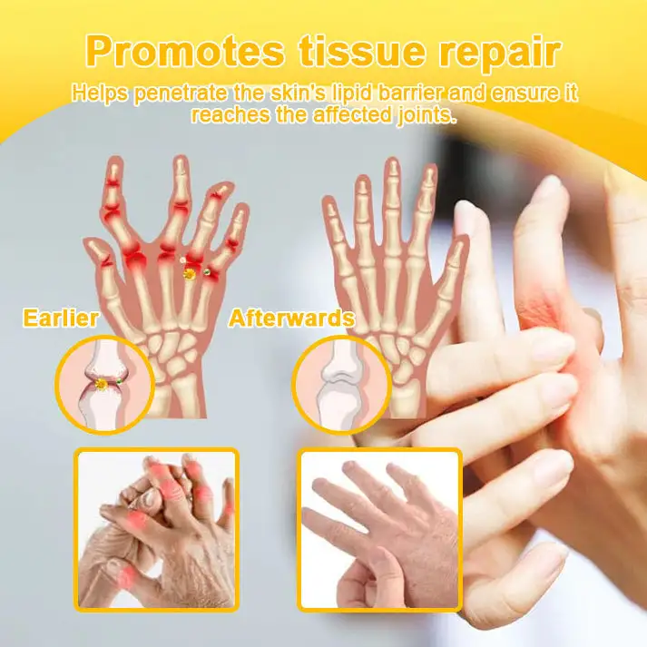 Botulinum Toxin and Bee Venom Pain Relief Bone Healing Cream - Image 12