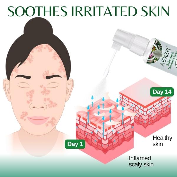 Seborrheic Dermatitis Spray - Image 4