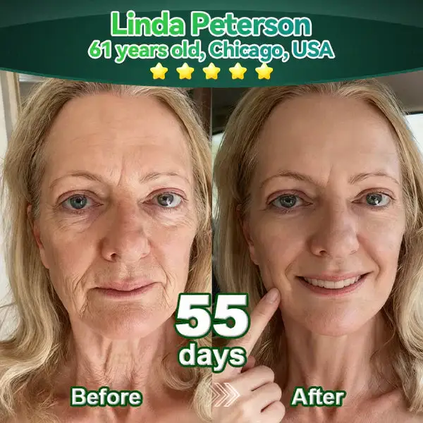 𝖢𝗁𝗅𝗈𝗋𝗈𝗉𝗁𝗒𝗅𝗅 & 𝑆𝑡𝑒𝑚 𝐶𝑒𝑙𝑙 𝖻𝗈𝖽𝗒 𝗋𝖾𝗇𝖾𝗐𝖺𝗅 𝗌𝖾𝗋𝗎𝗆 - Image 4