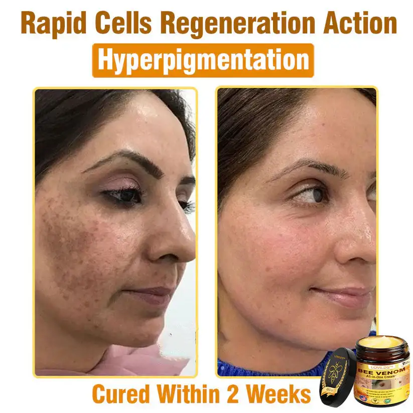 ๐๐๐ ๐๐๐ง๐จ๐ฆ ๐๐ฅ๐ฅ-๐ข๐ง-๐๐ง๐ ๐๐ซ๐๐๐ฆโAnti-Aging, Hydrating & Skin Repair - Image 10