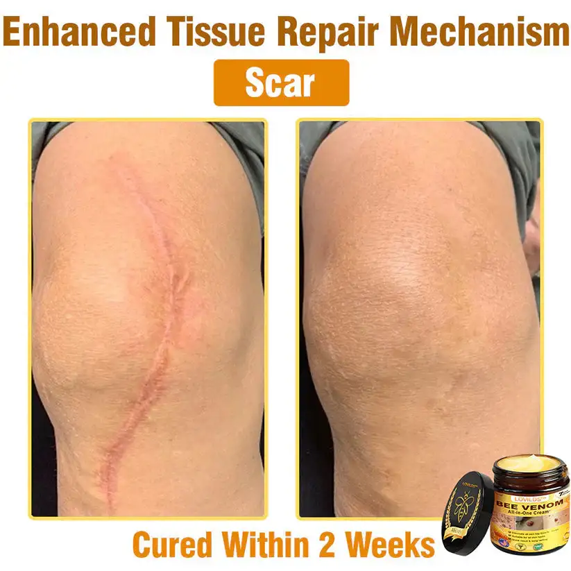 ๐๐๐ ๐๐๐ง๐จ๐ฆ ๐๐ฅ๐ฅ-๐ข๐ง-๐๐ง๐ ๐๐ซ๐๐๐ฆโAnti-Aging, Hydrating & Skin Repair - Image 13