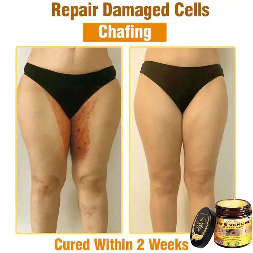 ๐๐๐ ๐๐๐ง๐จ๐ฆ ๐๐ฅ๐ฅ-๐ข๐ง-๐๐ง๐ ๐๐ซ๐๐๐ฆโAnti-Aging, Hydrating & Skin Repair - Image 9