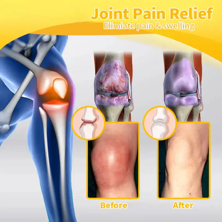Bee-Venom Pain Relief Bone Healing Cream - Image 13