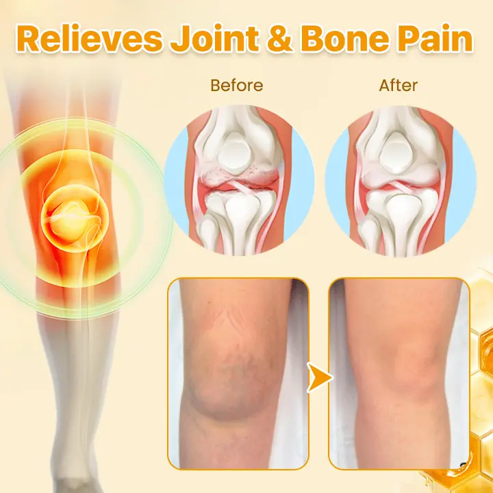 Bee Venom Joint Pain Relief & Healing Cream - Image 2