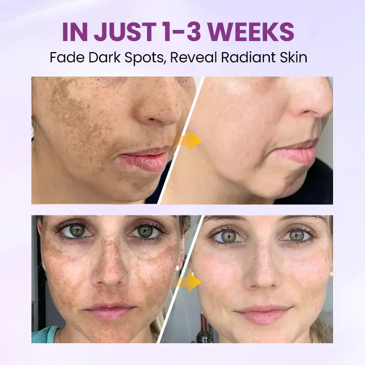 RadiantClear Blemish & Brightening Serum - Image 2