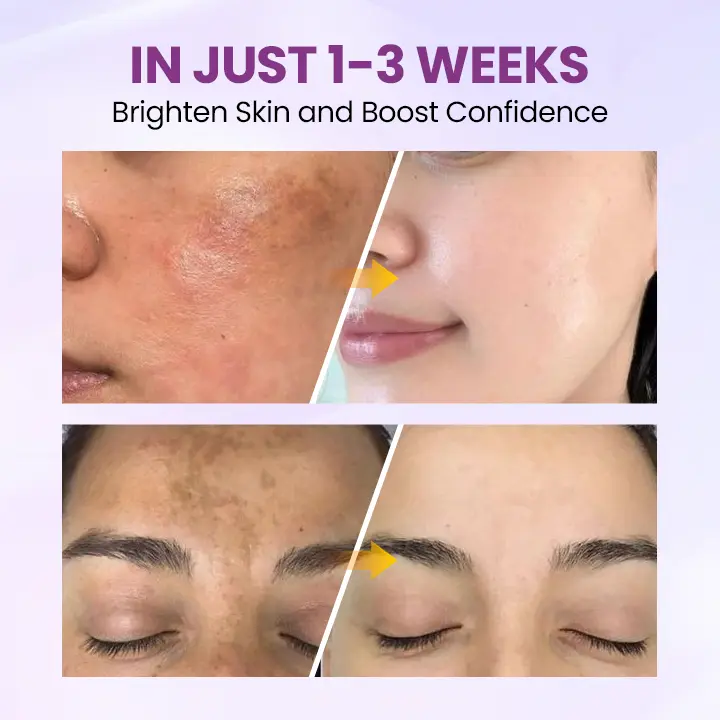 RadiantClear Blemish & Brightening Serum - Image 3
