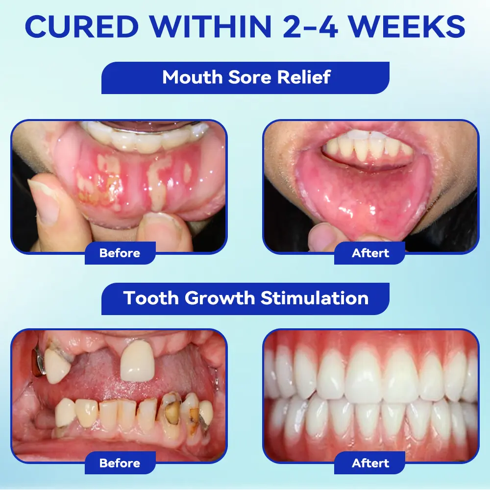Focus Smile Bee Venom Treatment Oral Powder - Image 6