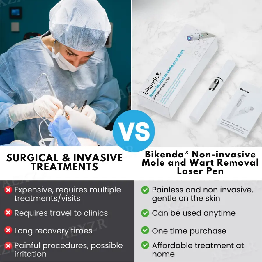 PRO Non-Invasive Mole and Wart Removal Laser Pen - Image 8