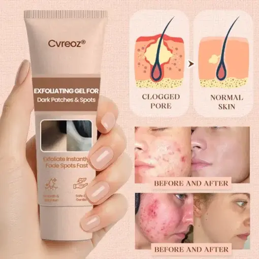 Purifying Exfoliating Gel - Image 7