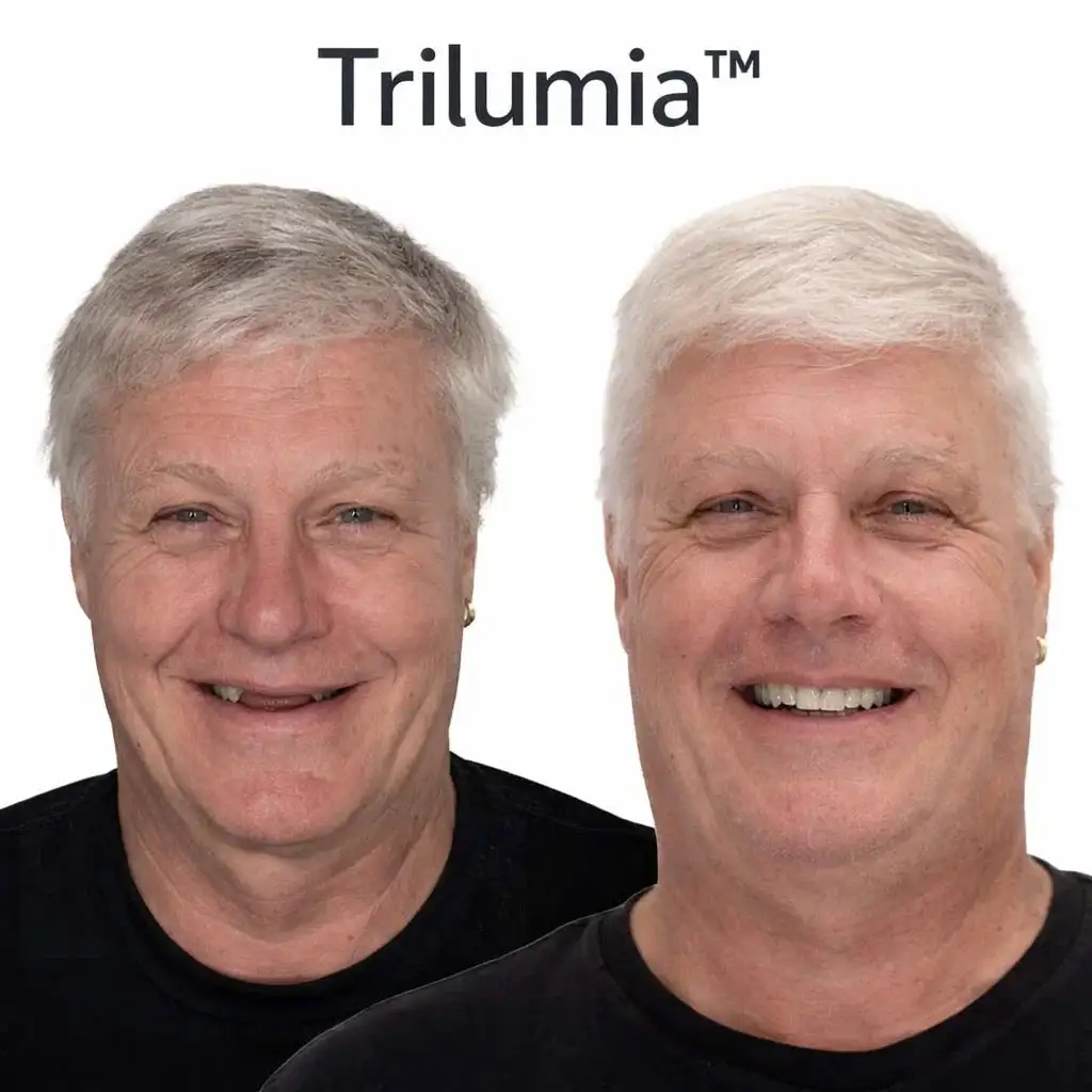 Custom-Fit Dentures - Image 9
