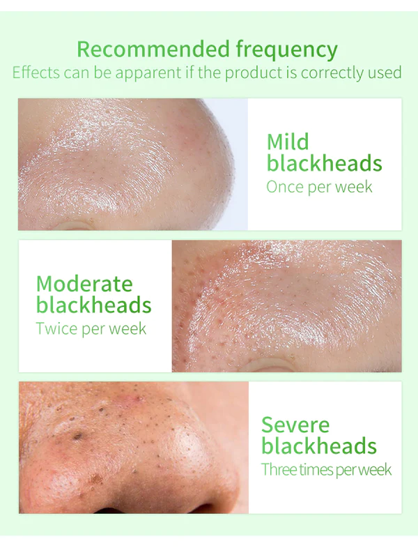 Facial Essence Blackhead Removal Kit - Image 7