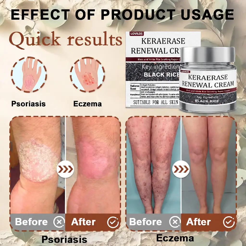 KeraErase Dual-Action Renewal Cream - Image 2