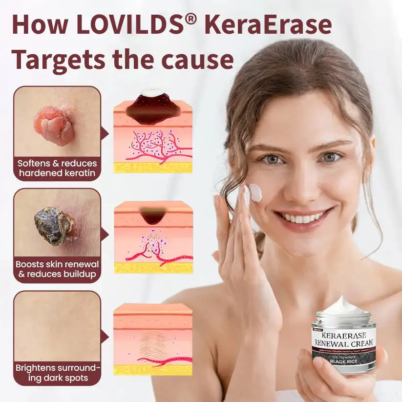 KeraErase Dual-Action Renewal Cream - Image 6