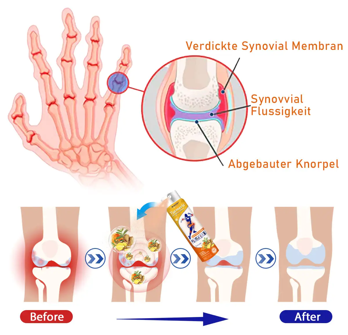 Turmeric Arthritis Spray - Image 8