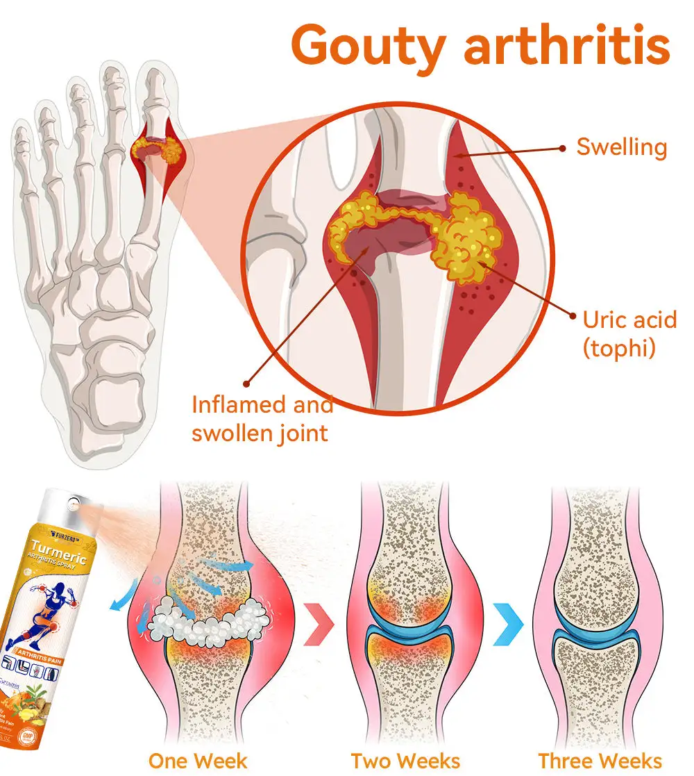 Turmeric Arthritis Spray - Image 9