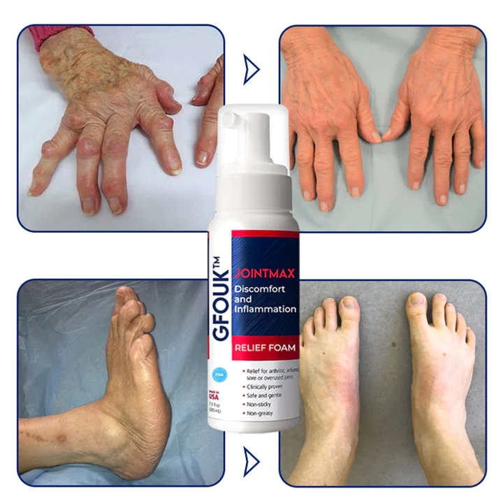JointMax Discomfort and Inflammation Relief Foam - Image 5