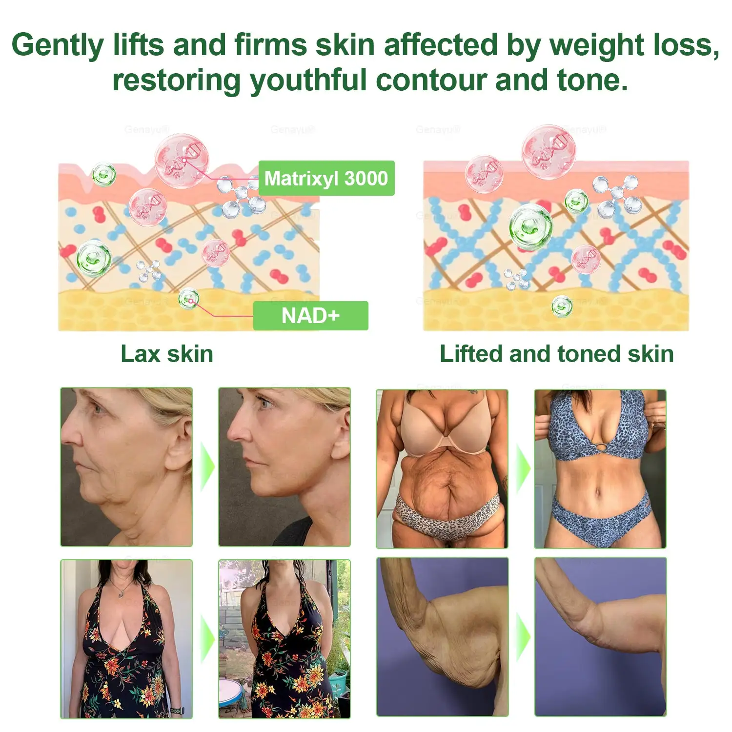 ️ MORINGA+BERBERINE Advenaced Nano Microneedle Patch - Image 7