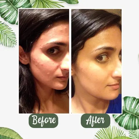 100% Natural Green Tea Deep Cleanse Mask - Image 4