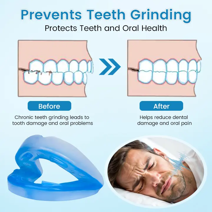 Anti-Snoring & Anti-Grinding Teeth Protector - Image 5