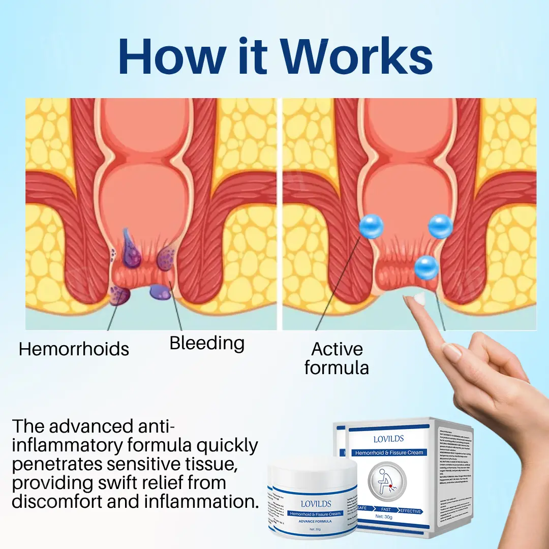 Hemorrhoid & Fissure Cream - Image 4