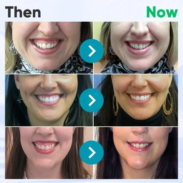 Gum Therapy Gel - Image 5