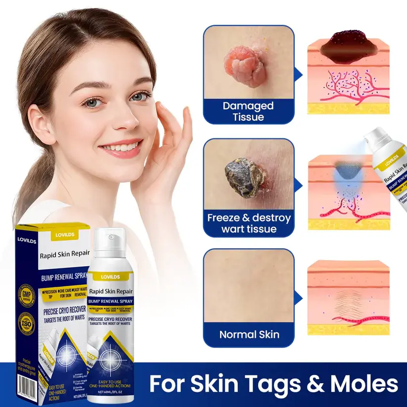 Rapid Skin Repair & Bump Removal Spray - Image 6