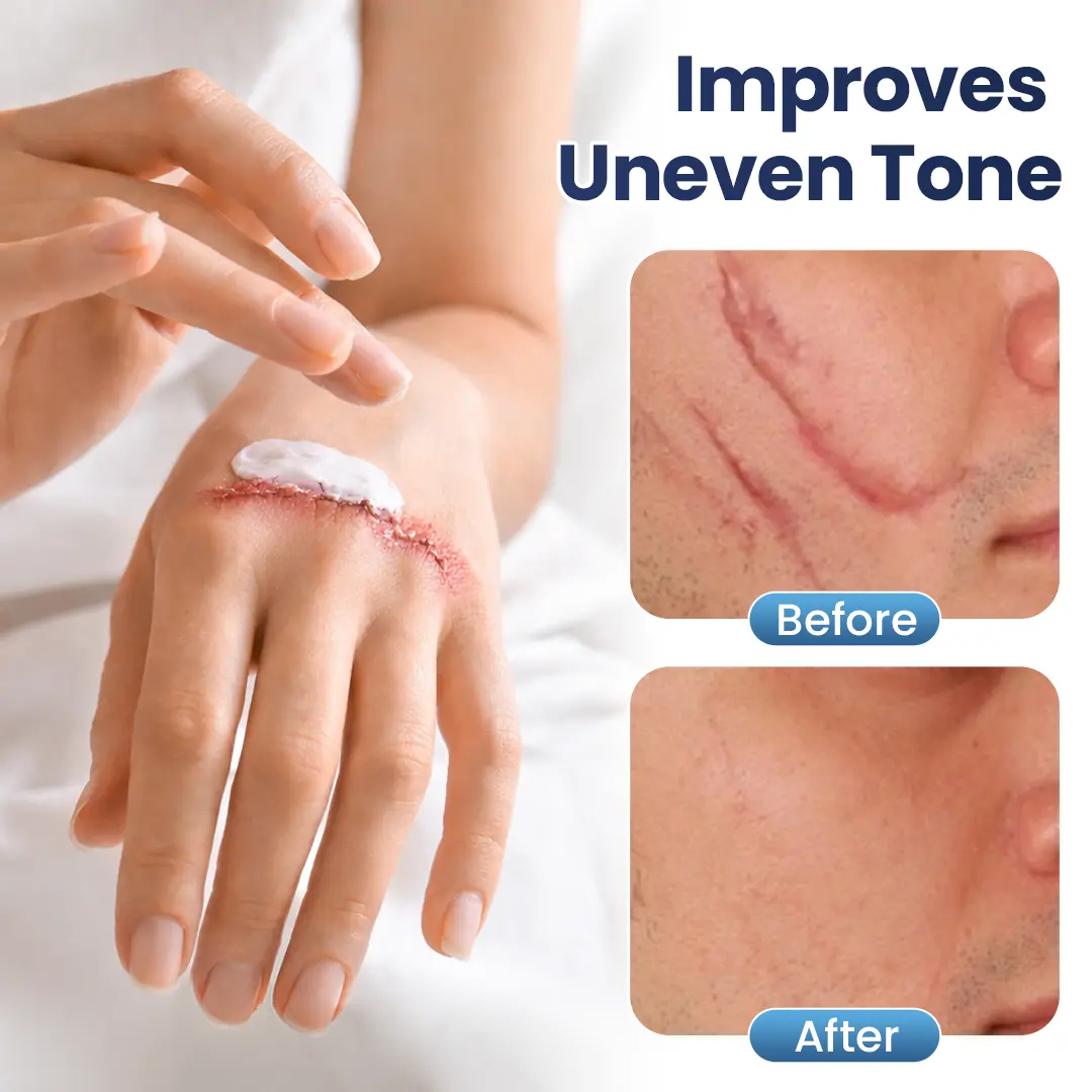 Texture Repair Gel - Image 4