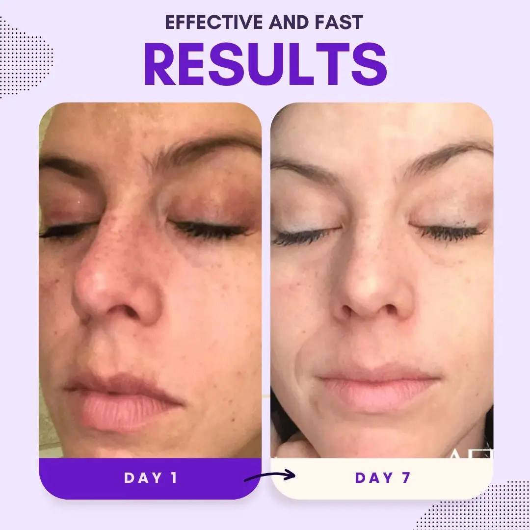 Thiamidol 630 Serum - Image 4