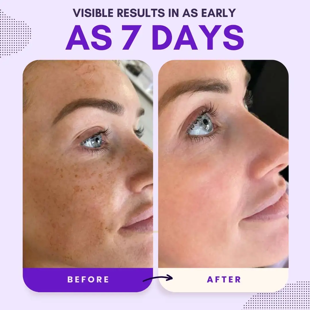 Thiamidol 630 Serum - Image 5