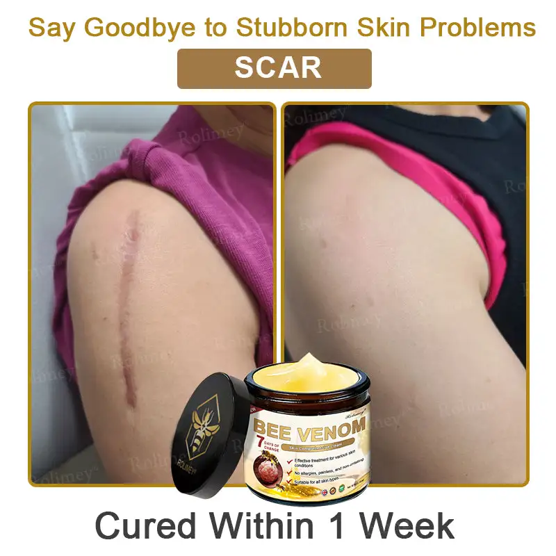 Bee Venom Skin Comprehensive Cream - Image 10