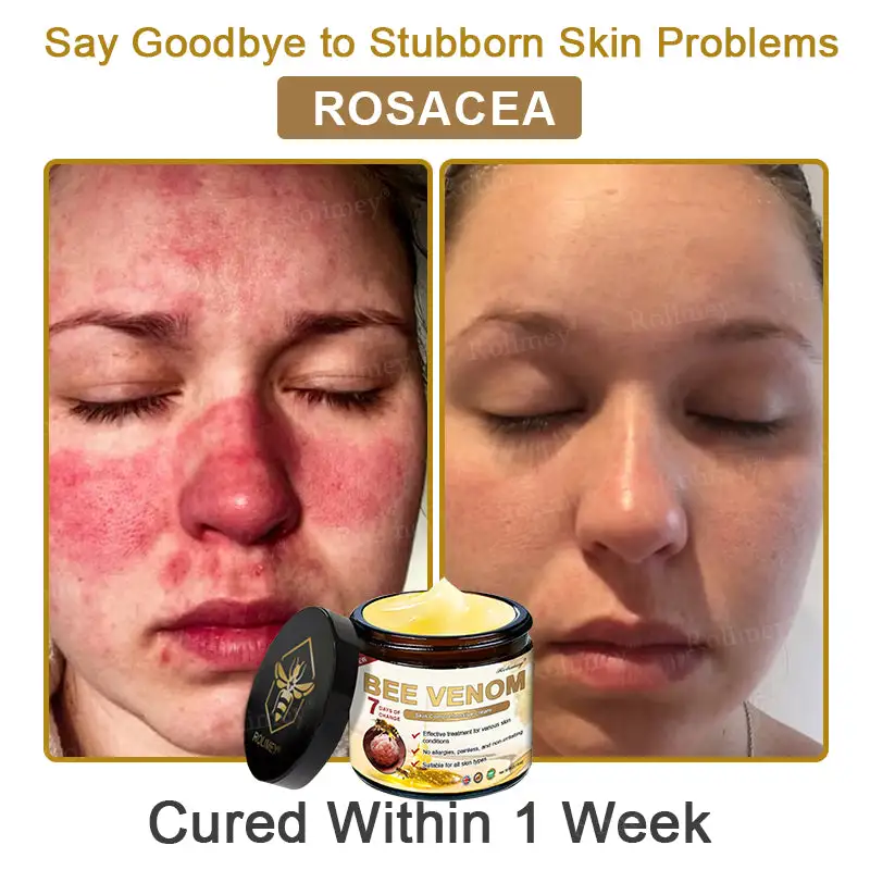 Bee Venom Skin Comprehensive Cream - Image 6