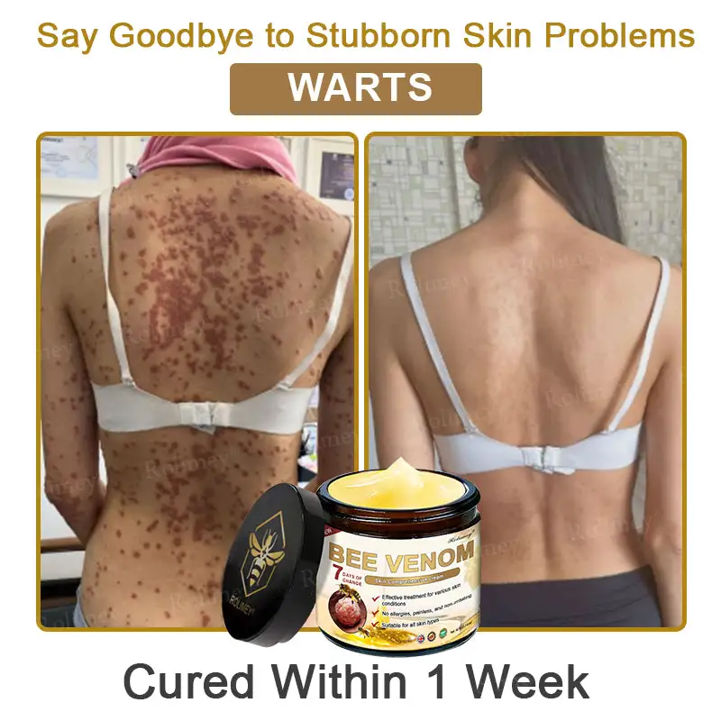 Bee Venom Skin Comprehensive Cream - Image 8