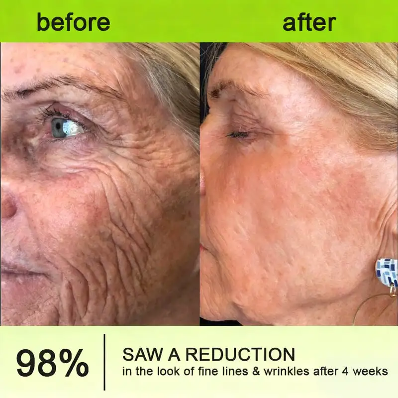 Botox Vitamin A Retinol Anti-Wrinkle Firming and Lifting Cream - Image 17